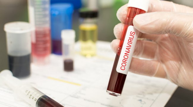 Tansiyon ilaçları koronavirüs vefatlarını artırıyor mu?