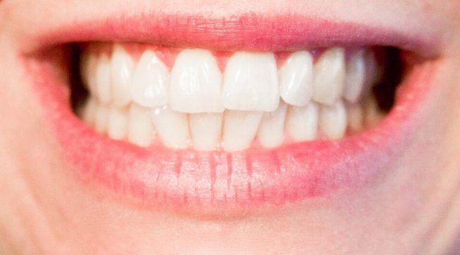 Dişlere hasar veren alışkanlıklar