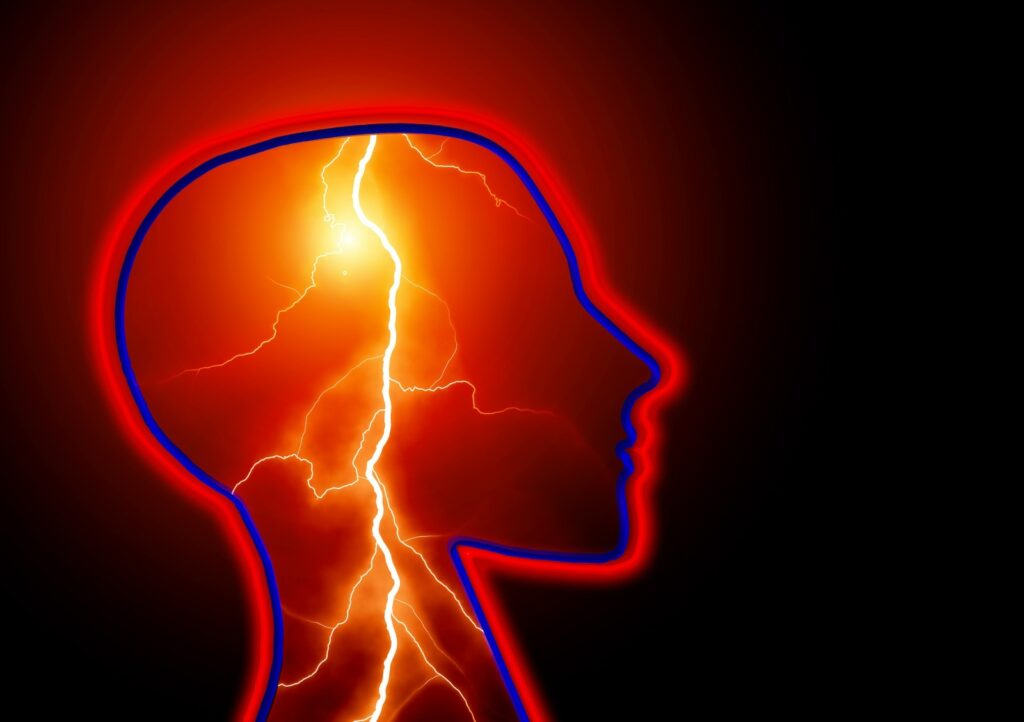 Epilepsi