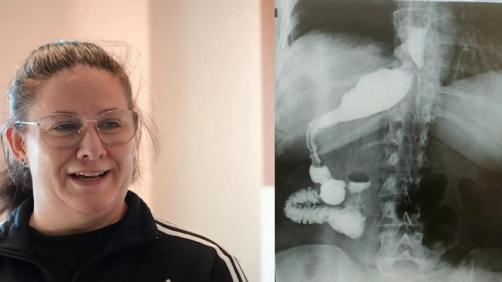 100 binde bir görülüyor: Zayıflamak için masaya attı, hekimler gördükleri karşısında şoke oldu