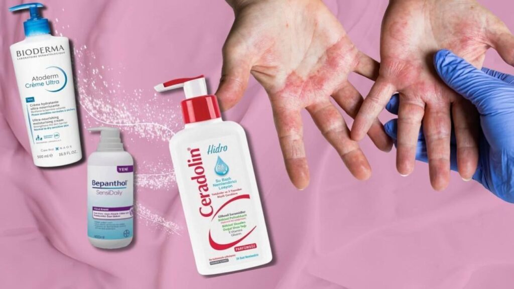 Atopik ciltler için en uygun kremler hangisi? Dermatolog teklifiyle atopik cilt için 3 krem