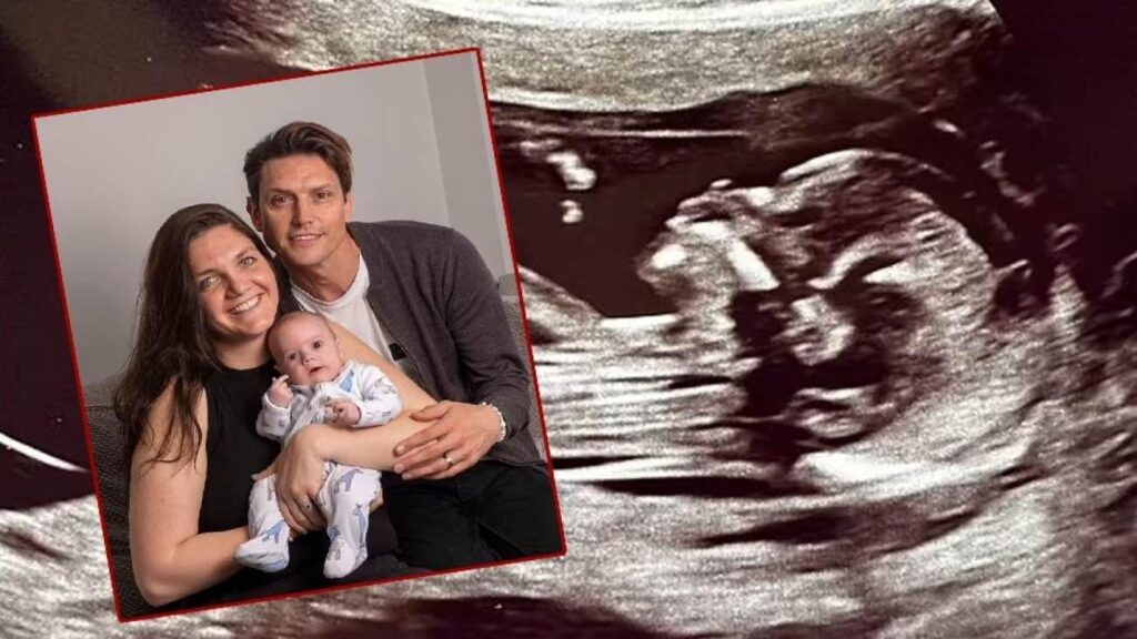 Bir bebek iki kere doğdu! Tıp literatürüne girdi