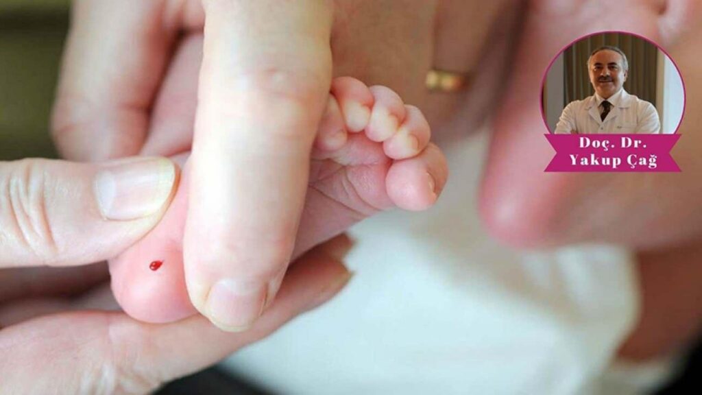 Bitmeyen tartışma: Topuk kanı! Doç. Dr. Yakup Çağ ebeveynlere değerli ikazlarda bulundu