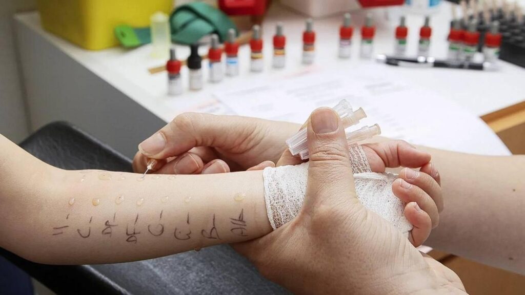 Çocuklarda alerji testi nasıl yapılır? Deri prick testi nedir?