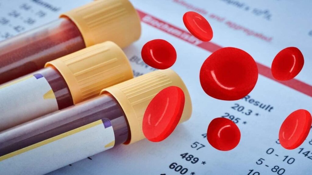 Dünyada en az bulunan kan kümesi: Rh-null! Altın kan kümesi nedir?