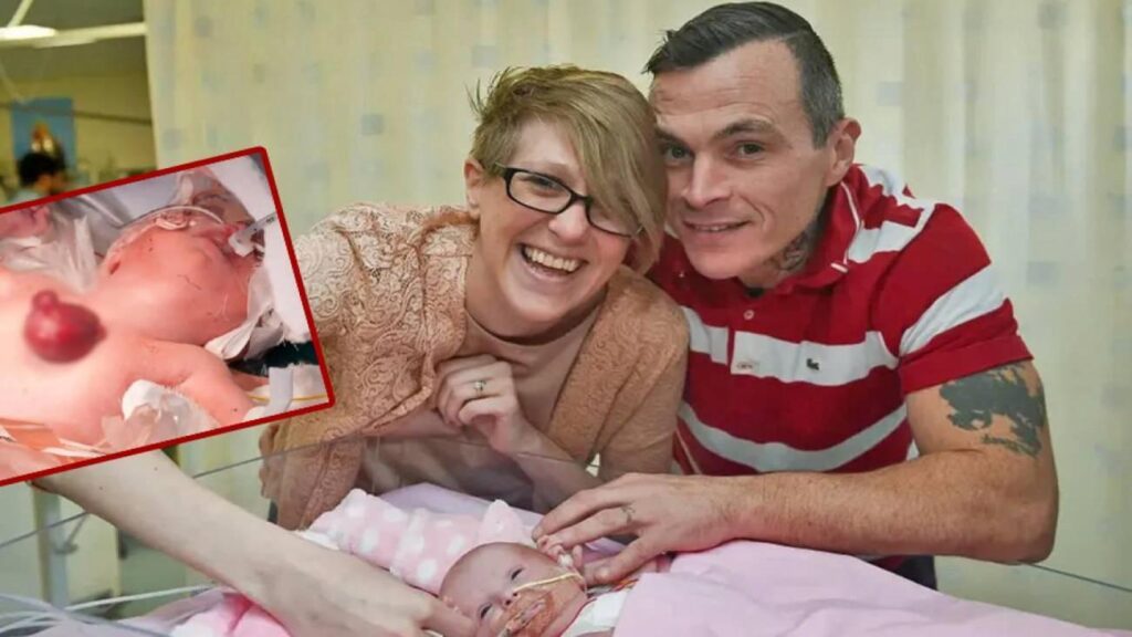 Kalbi dışarıda doğdu! 7 yaşındayken ameliyatla göğüs kafesine yerleştirildi