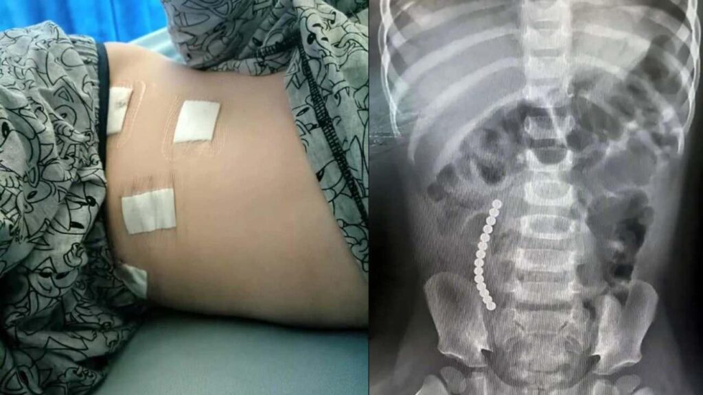 Öldüren TikTok akımı: 12 yaşındaki çocuk son anda kurtarıldı