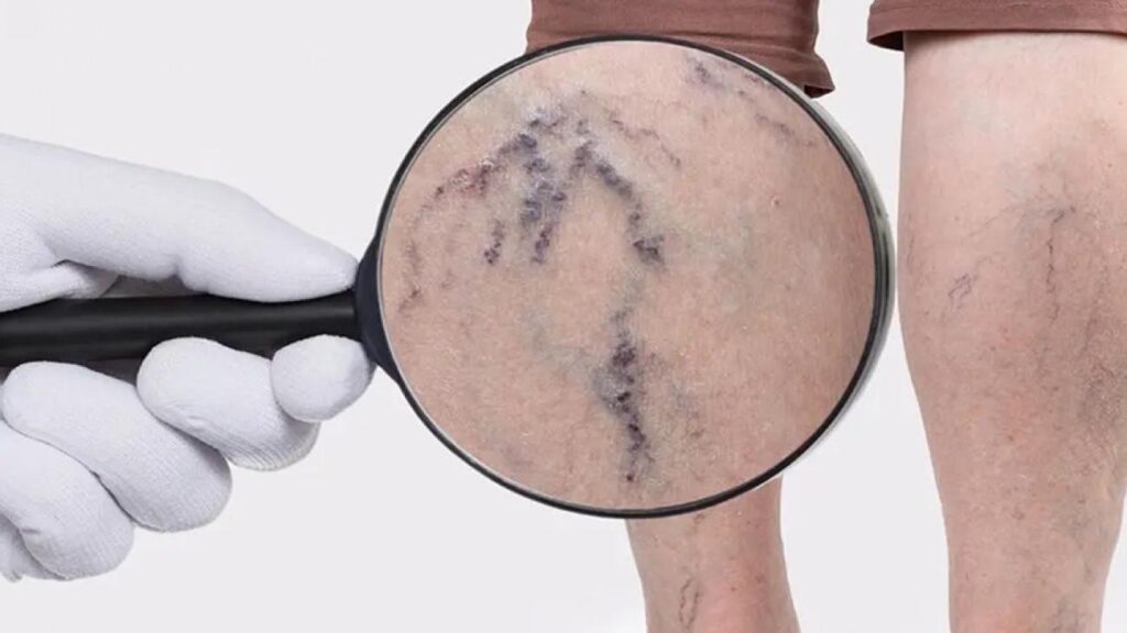 Prof. Dr. Ünal Aydın varisler hakkında gerçek bilinen yanlışlara açıklık getirdi!