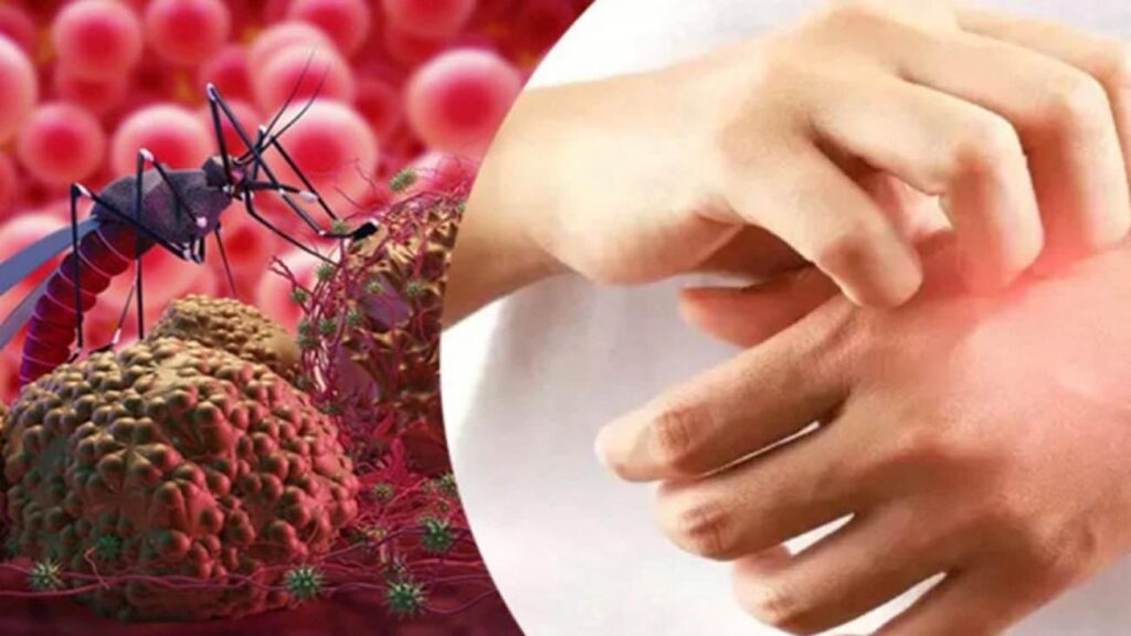 Seyahat edenler dikkat! Yüksek ateşle başlıyor vefata neden olan tehlike: Sıtma