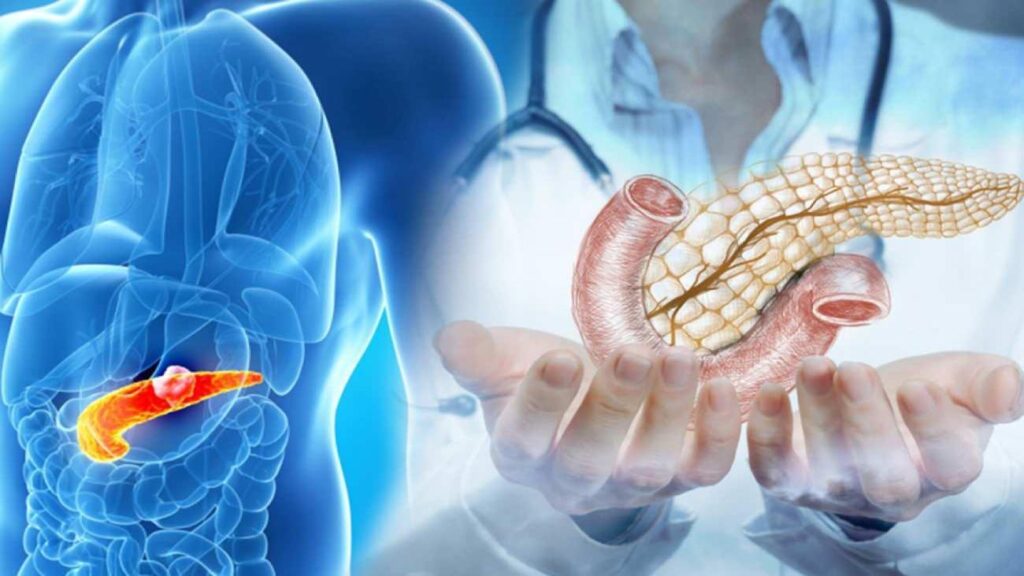 Ünlü doktor pankreas kanseri riskini artıran besinleri açıkladı: DNA hasarına neden oluyor