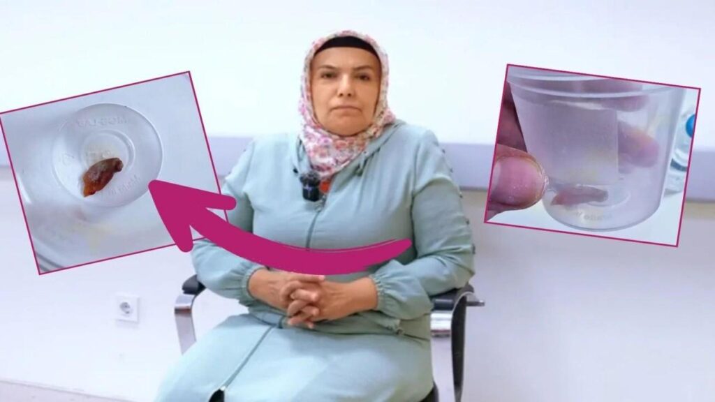 1,5 yıldır durmadan öksüren bayanın boğazından çıkan herkesi şoke etti!