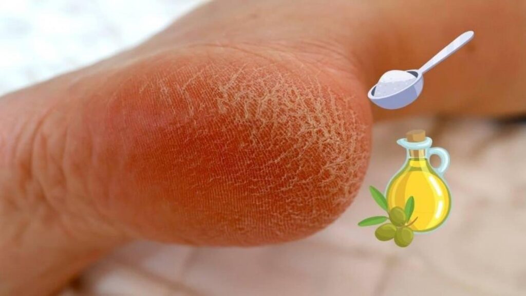 Çatlamış topuklara mucize çözüm! Yalnızca 2 gereç ile yumuşacık oluyor