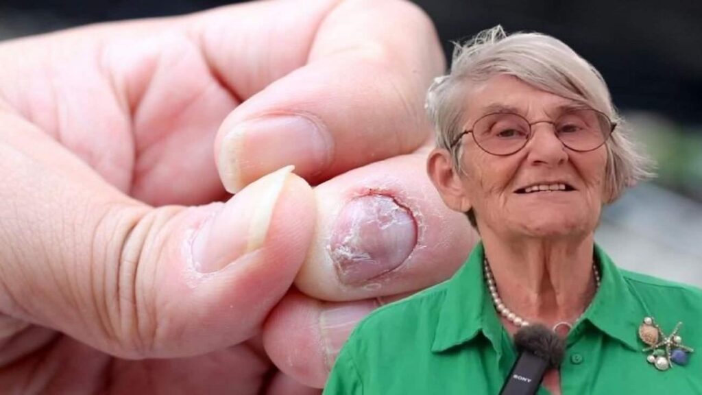 Prof. Dr. Canan Karatay’dan doğal reçete: Cilt ve ayak mantarına karşı tesirli çözüm!