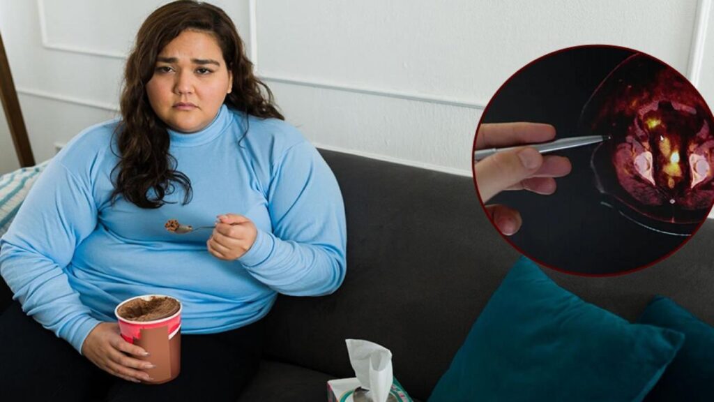 Uzman isim uyardı: Obezitenin gölgesinde gözden kaçan ‘kanser’ tehdidi!