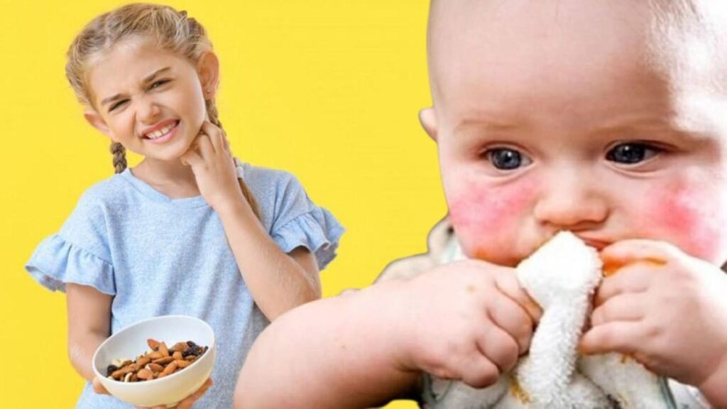 Uzman uyardı: “Besin alerjisi olan çocuklarda arkadaş ikramı hastanelik edebilir”