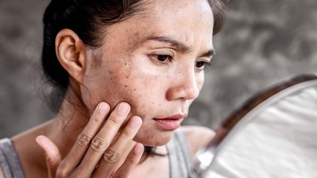 Yaz sıcaklarında cildimizi nasıl koruyalım? Güneş yanıklarına karşı dikkat çeken ikaz