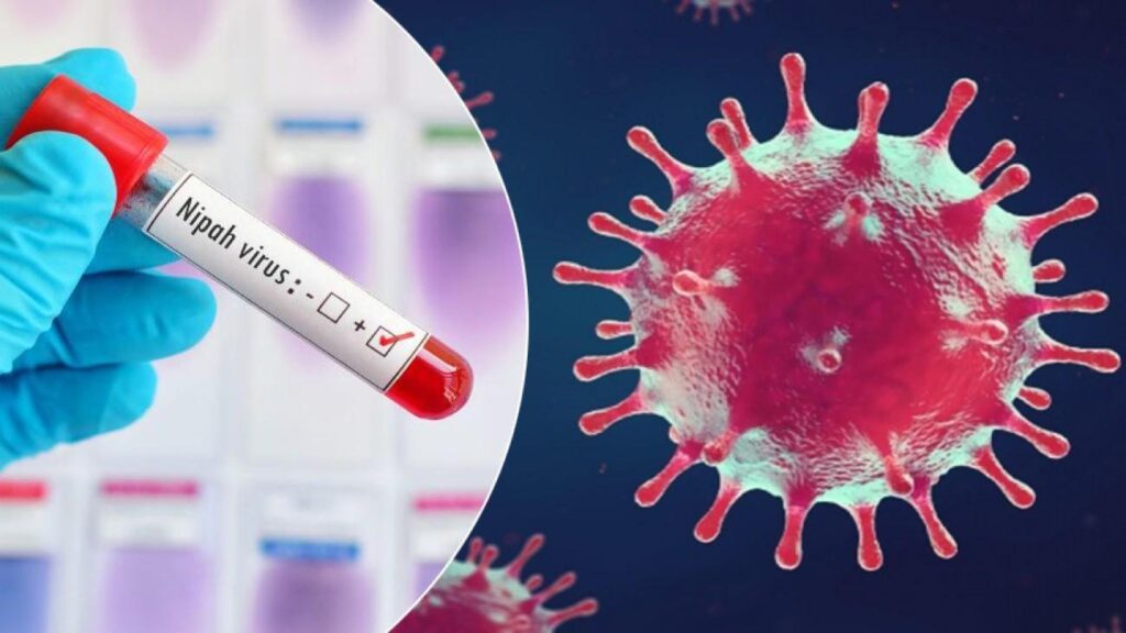 Dünya Sıhhat Örgütü alarm verdi: Nipah virüsü nedir, Türkiye’de var mı?