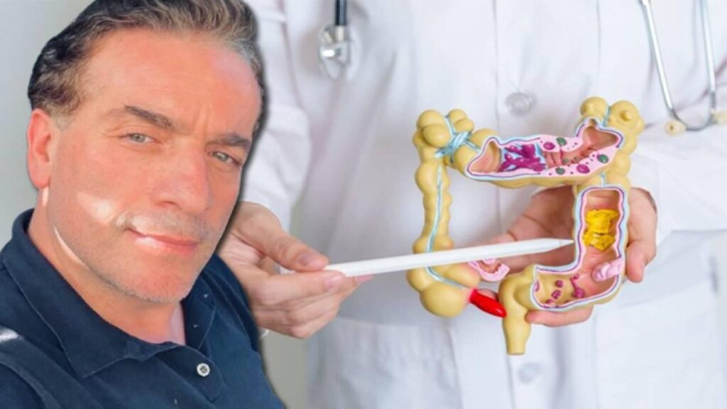 Murat Cemcir’i ağır bakımlık eden hastalık divertikül kanaması nedir?