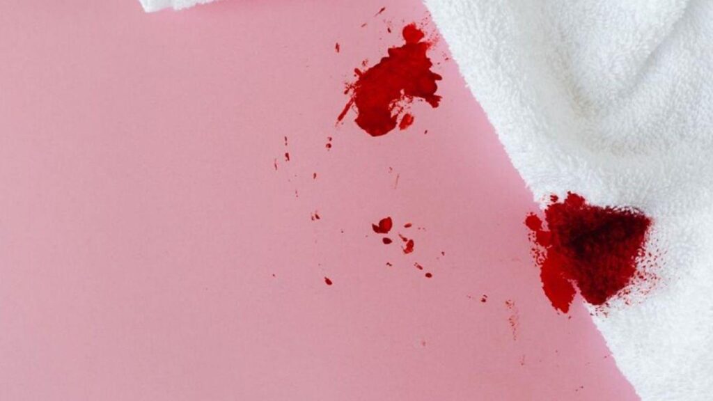 Hemoroid deyip geçmeyin: Kanama hayati bir hastalığın sinyali olabilir!